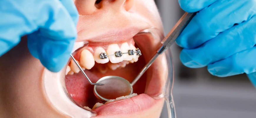 Beşiktaş Diş Hekimi