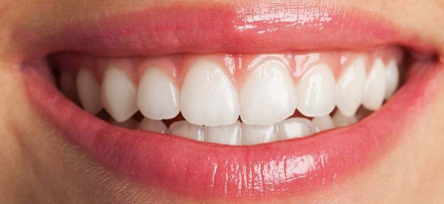 Estetik Diş Dolgusu