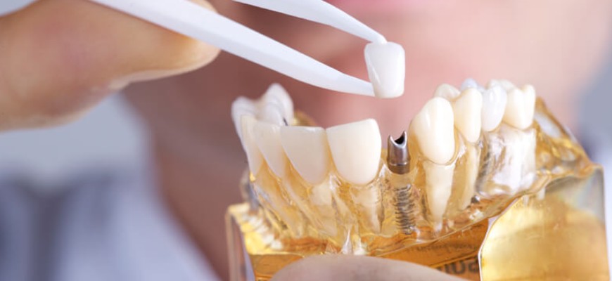 Osmanbey Diş Hekimi